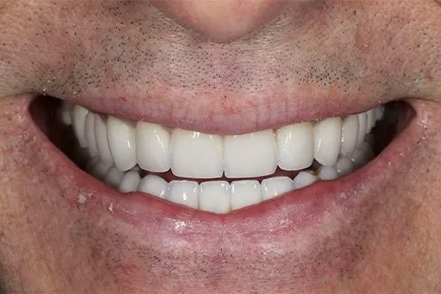 arlington-heights-cosmetic-dentist-1
