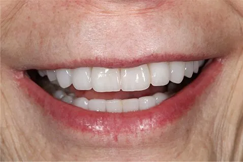 arlington-heights-il-cosmetic-dentist-1