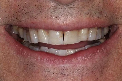 cosmetic-dentist-near-me