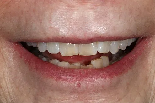 dentist-arlington-heights-1