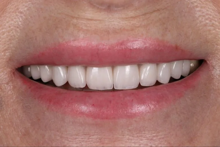 Case-19-After-768x512