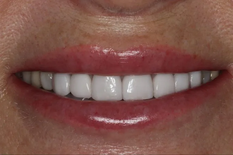 Case-19-Before-768x512