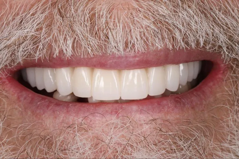 Case-22-After-768x512