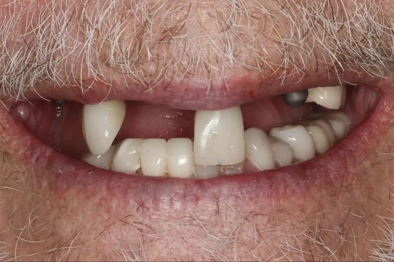 Case-22-Before-768x512