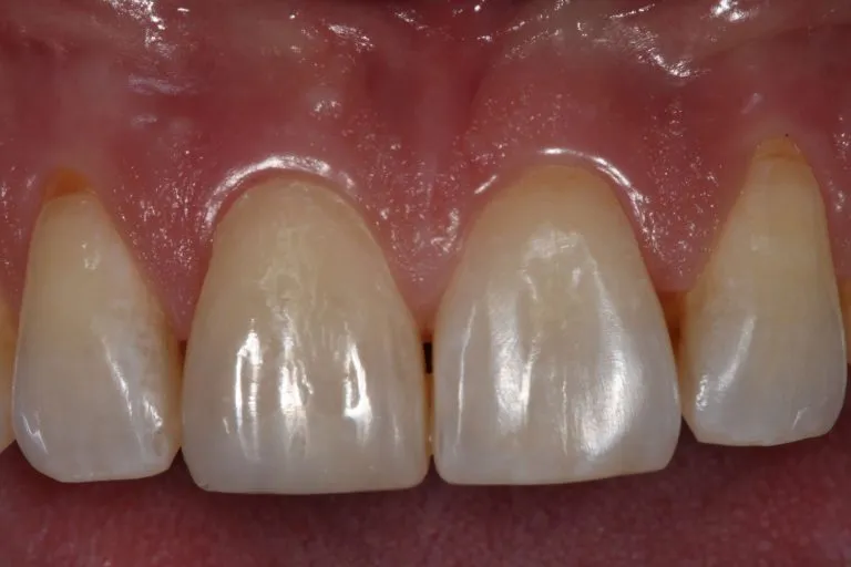 after-2-edited-768x512