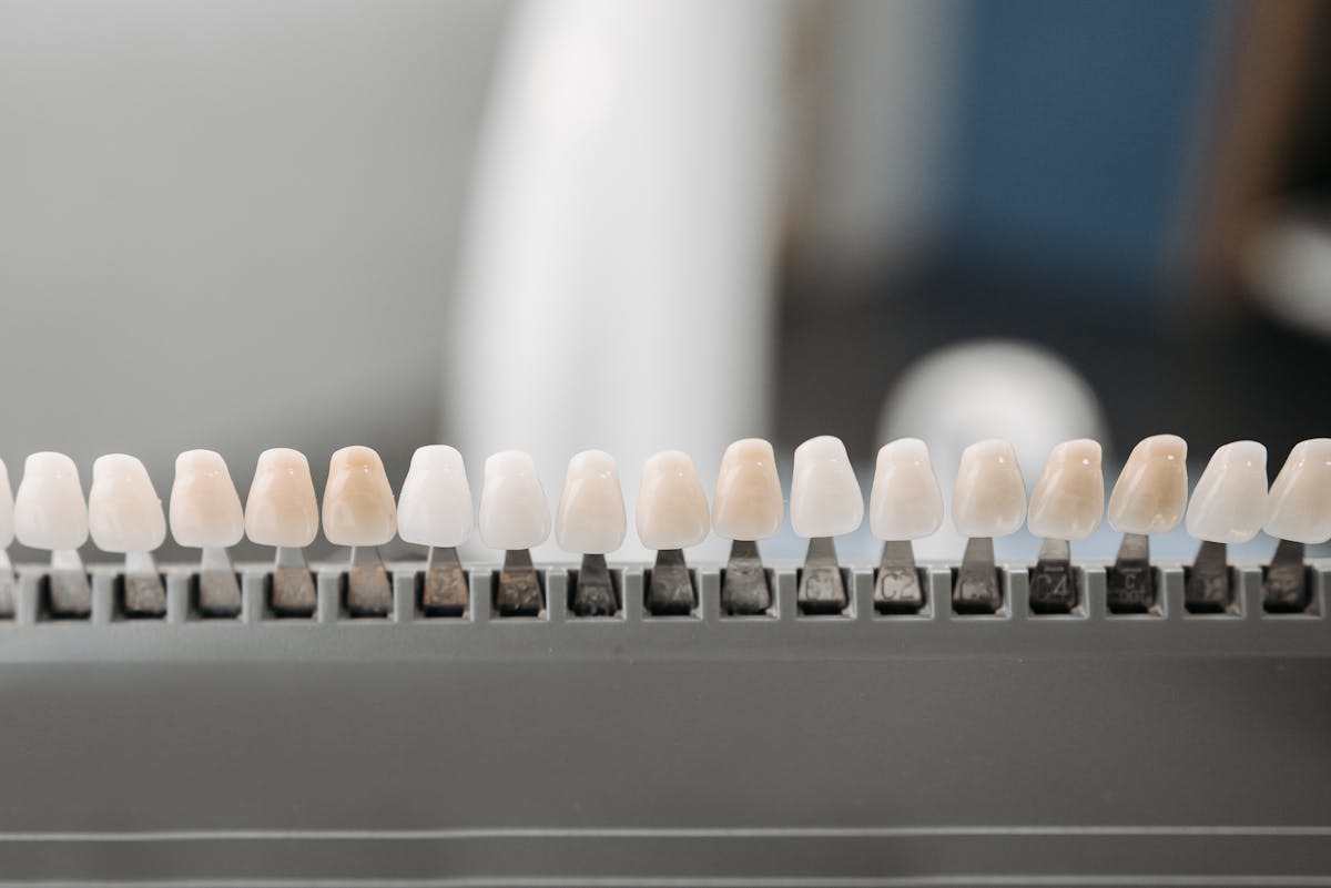 Can Porcelain Veneers Strengthen Damaged Teeth?
